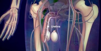 Urethral Stricture treatment in Sangamner