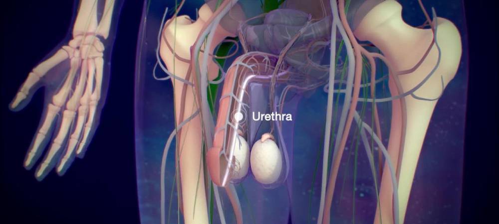 Urethral Stricture treatment in Sangamner